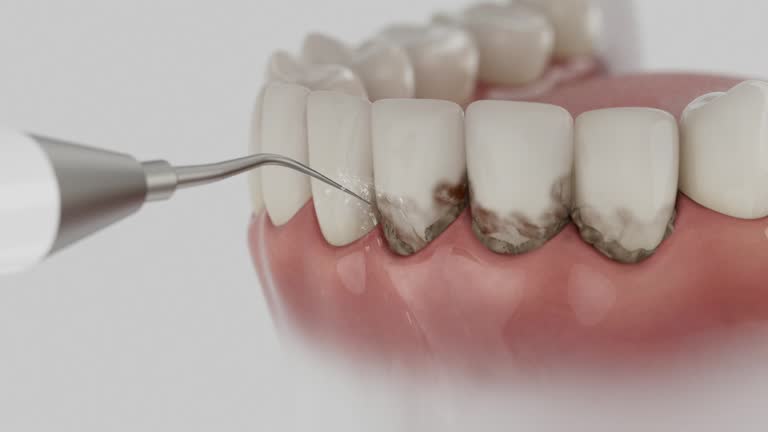Reliable Dental Implants contractor in Vega, TX by Smile Center Dentistry